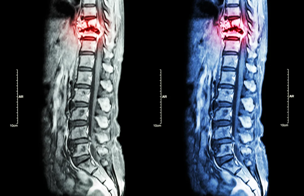 Spinal cord image. 